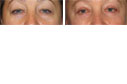 Before & After Photos